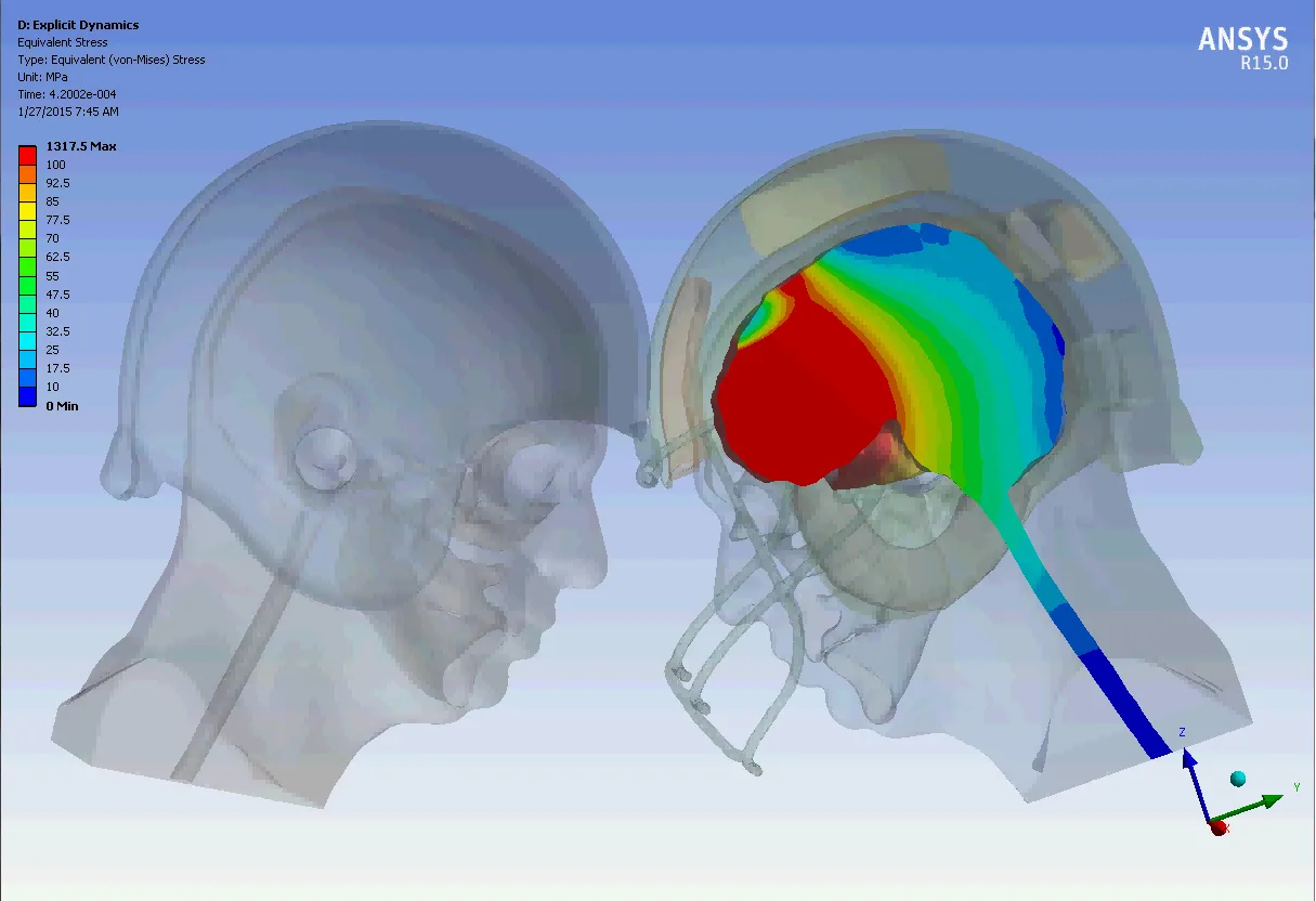 ANSYS